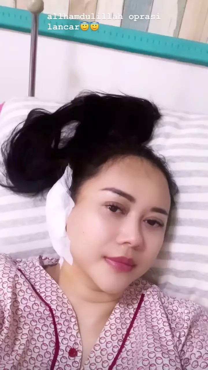 cerita aura kasih operasi © Instagram