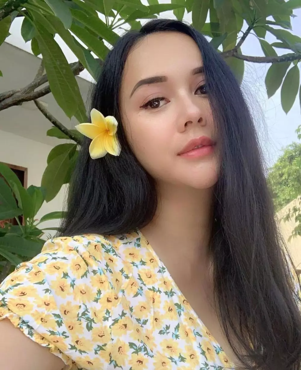 cerita aura kasih operasi © Instagram