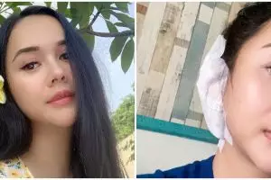 5 Cerita Aura Kasih operasi gendang telinga, minta doa kesembuhan