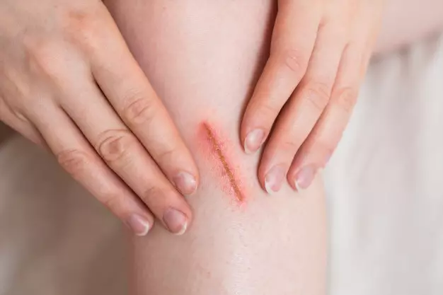 Manfaat daun pepaya untuk kecantikan dan kesehatan freepik.com