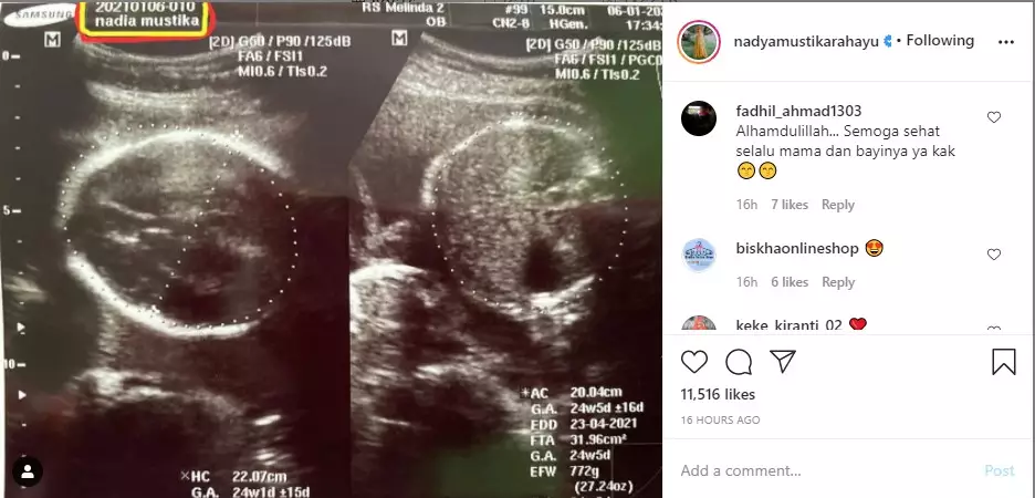 Nadya Mustika ungkap jenis kelamin anak   © Instagram