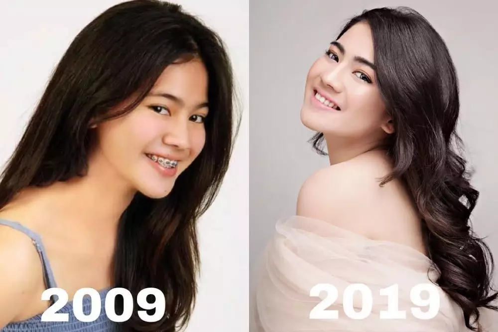 gaya rambut Felicya © Instagram