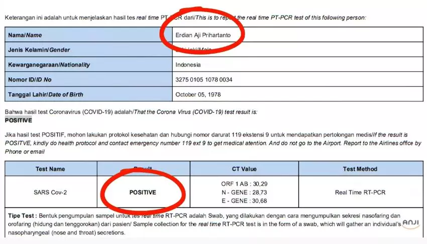 cerita anji positif covid © YouTube