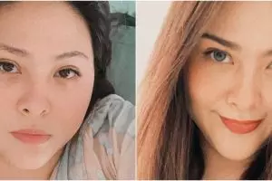 Cerita Audy Item berjuang sembuh dari Covid-19, tiap hari nangis