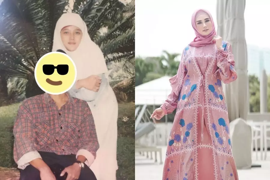 Penyanyi cantik sebelum dan sesudah terkenal © Instagram Penyanyi cantik sebelum dan sesudah terkenal © Instagram