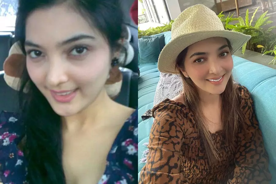 Penyanyi cantik sebelum dan sesudah terkenal © Instagram Penyanyi cantik sebelum dan sesudah terkenal © Instagram