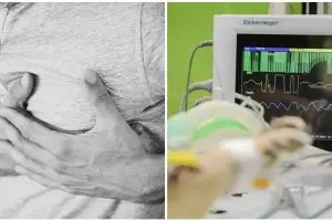 Mengenal penyakit diseksi aorta dan cara penanganannya