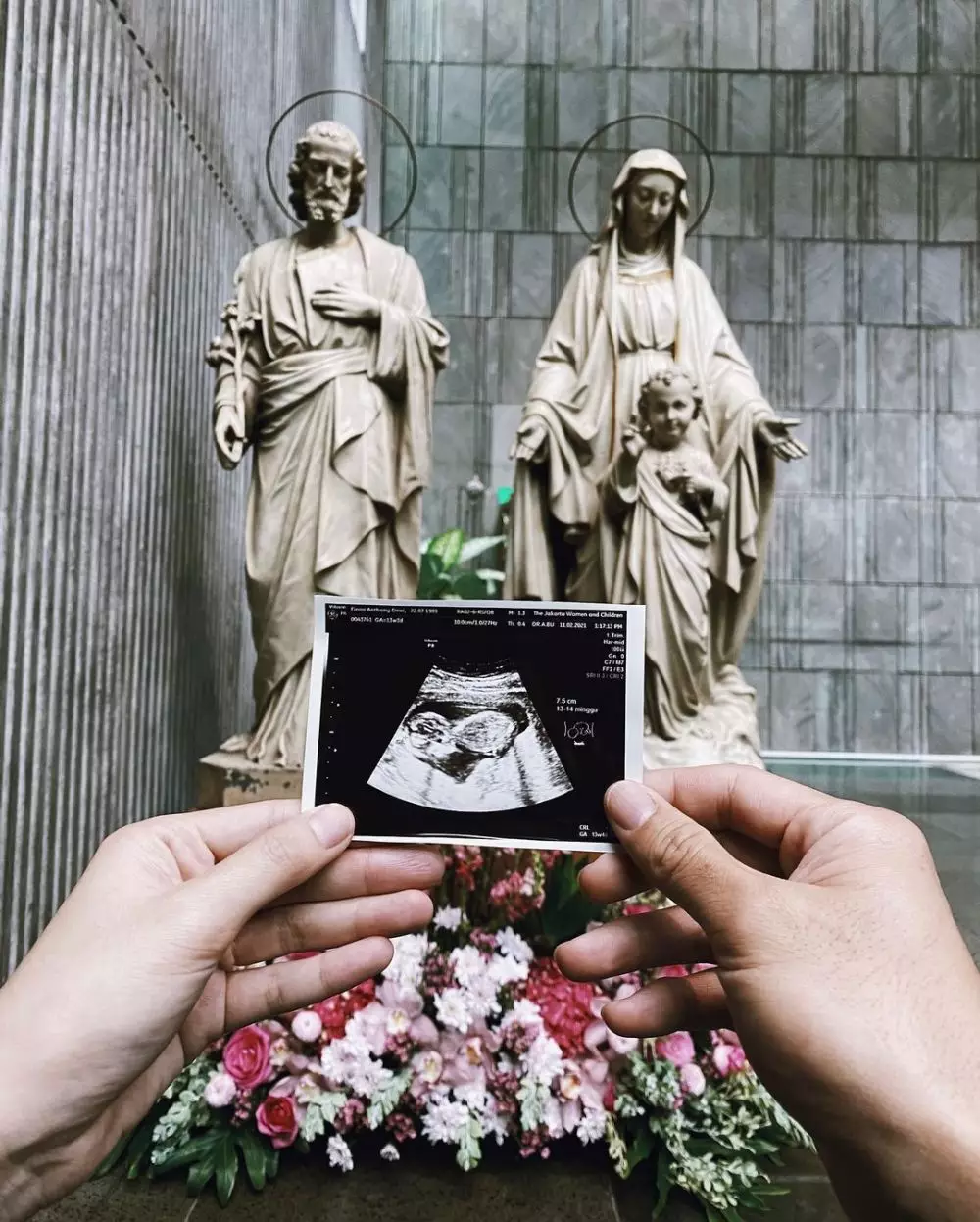 Dion Wiyoko & istri umumkan kehamilan Instagram