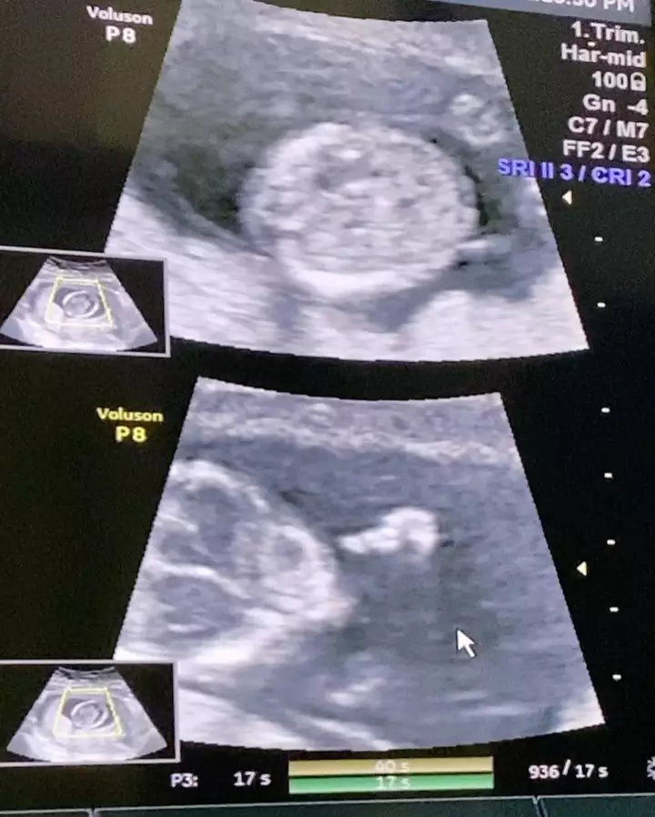 Dion Wiyoko & istri umumkan kehamilan Instagram