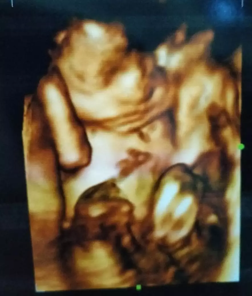 Nadya Mustika unggah foto USG Instagram © 2021 brilio.net Nadya Mustika unggah foto USG Instagram © 2021 brilio.net