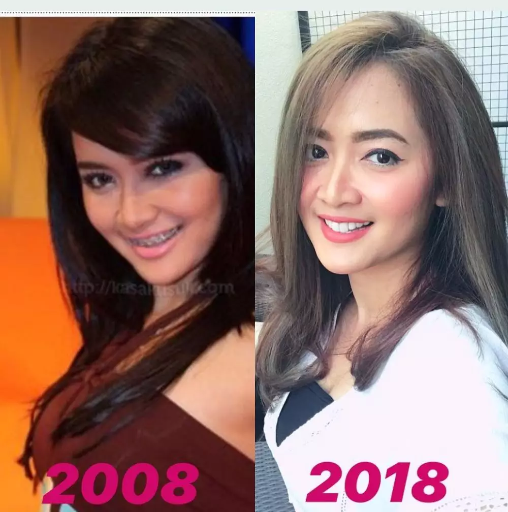 Potret lawas Vega Darwanti © berbagai sumber