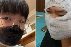 10 Masker ini punya bentuk nyeleneh, bikin tepuk jidat