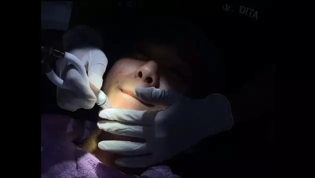 Iqbaal Ramadhan lakukan perawatan kulit © 2021 brilio.net Iqbaal Ramadhan lakukan perawatan kulit © 2021 brilio.net