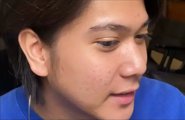 Iqbaal Ramadhan lakukan perawatan kulit © 2021 brilio.net Iqbaal Ramadhan lakukan perawatan kulit © 2021 brilio.net