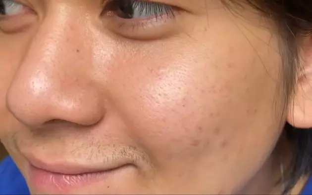 Iqbaal Ramadhan lakukan perawatan kulit © 2021 brilio.net Iqbaal Ramadhan lakukan perawatan kulit © 2021 brilio.net