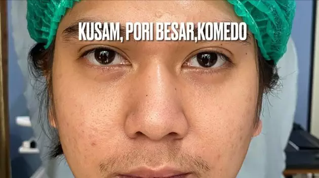 Iqbaal Ramadhan lakukan perawatan kulit © 2021 brilio.net Iqbaal Ramadhan lakukan perawatan kulit © 2021 brilio.net