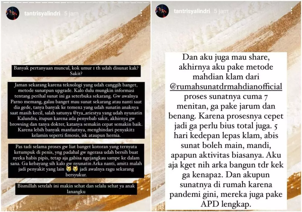 Tantri sunatkan anaknya © 2021 brilio.net