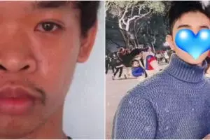 Ditolak kerja karena kurang tampan, pria ini lakukan 9 operasi plastik