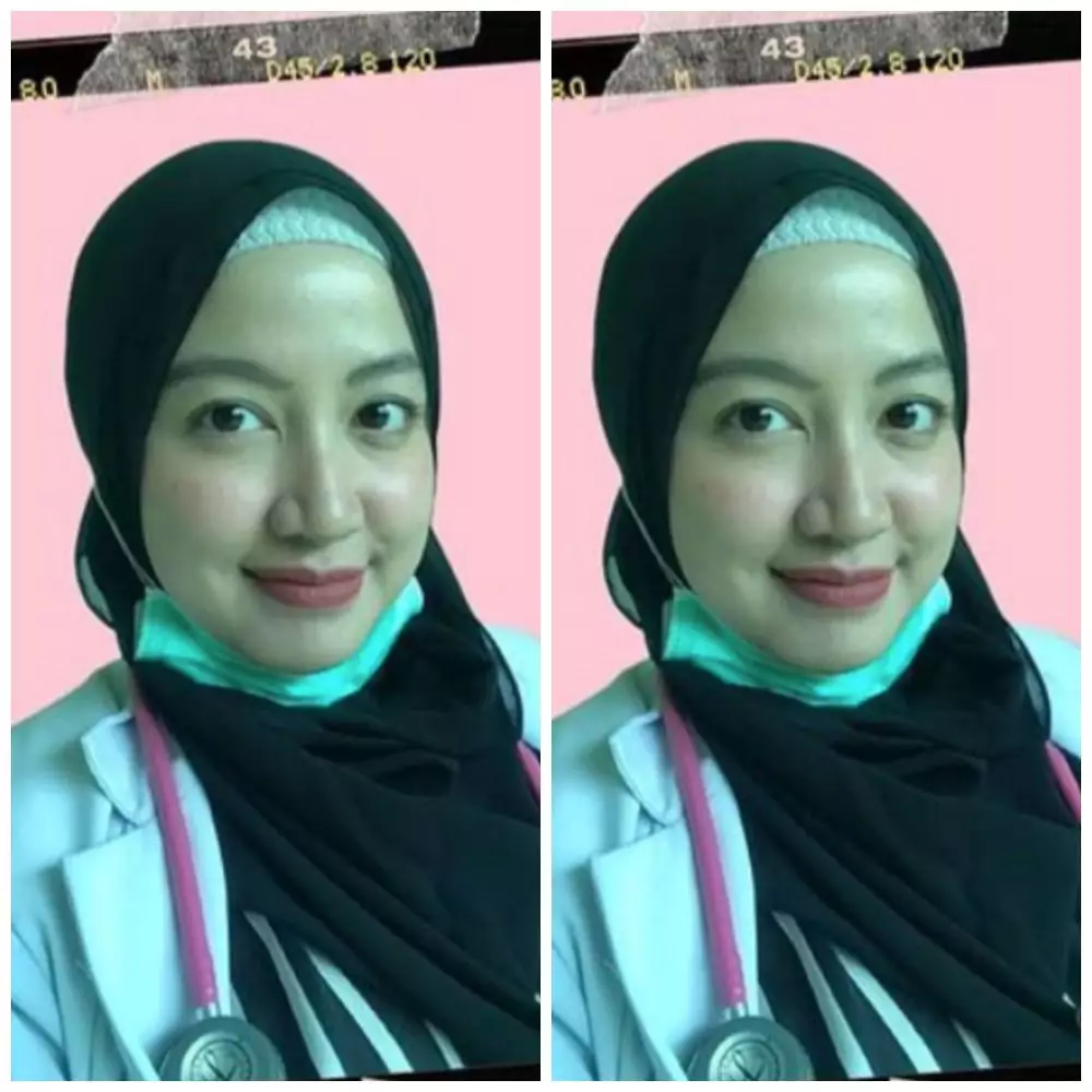 Mantan artis cilik sekarang jadi dokter © 2021 brilio.net