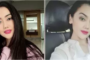 4 Cerita Nia Anggia positif Covid-19, sempat hilang indra penciuman