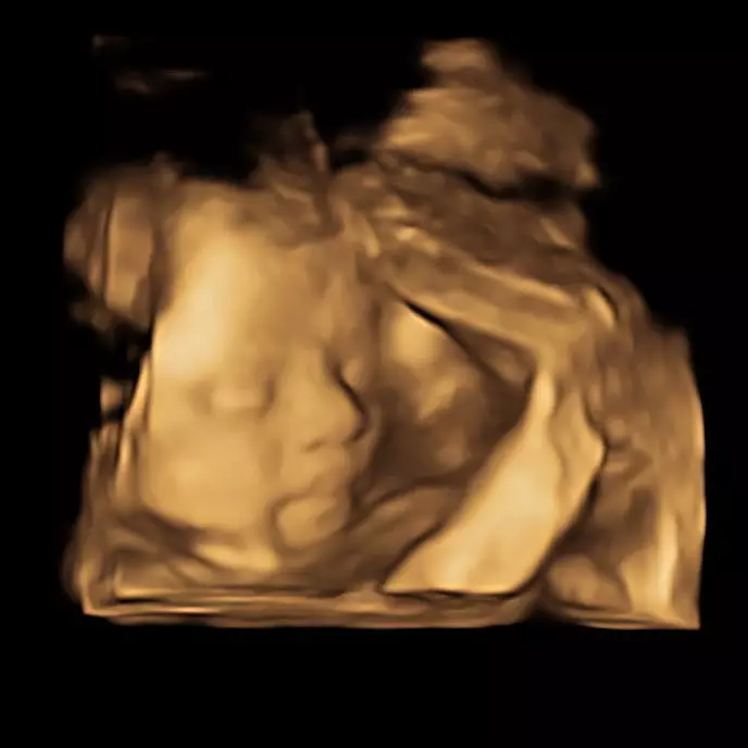 Rey Mbayang unggah foto USG bayi Dinda Hauw Instagram © 2021 brilio.net Rey Mbayang unggah foto USG bayi Dinda Hauw Instagram © 2021 brilio.net