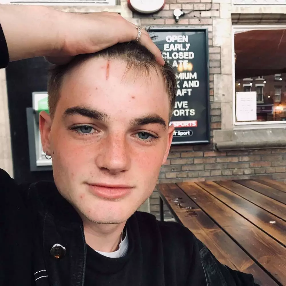 Ingat Albus Severus Potter? Instagram