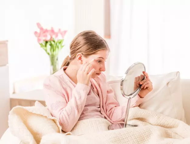 obat hilangkan cacar air © freepik.com