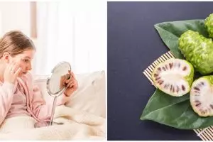 7 Tanaman obat bantu hilangkan bekas cacar air, efektif dan cepat