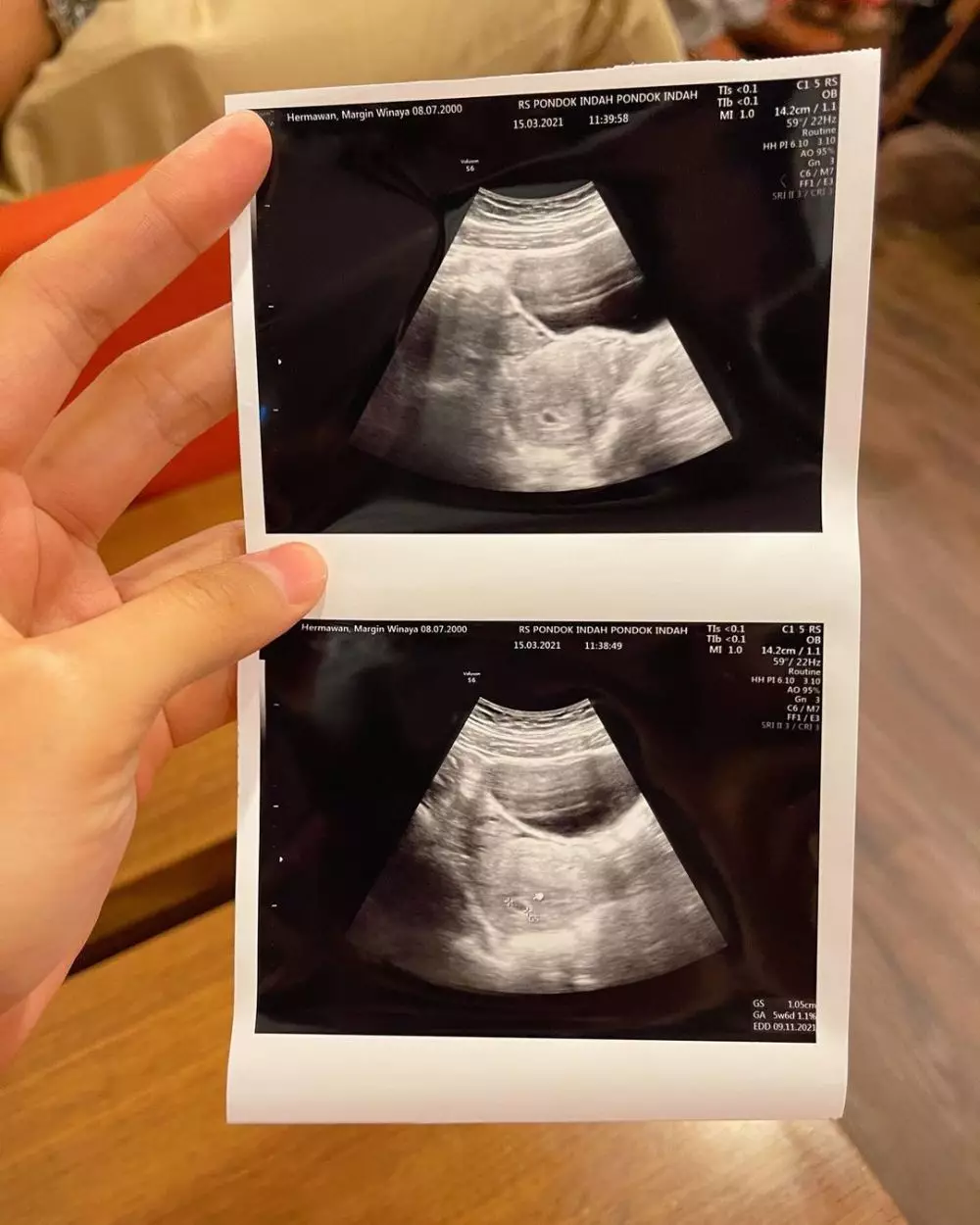 Margin Wieherrm dan Ali Syakieb umumkan kehamilan YouTube Margin Wieherrm dan Ali Syakieb umumkan kehamilan YouTube