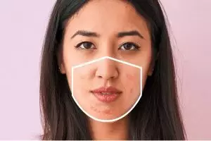 3 Hal yang wajib kamu ketahui soal maskne, kelamaan pakai masker nih