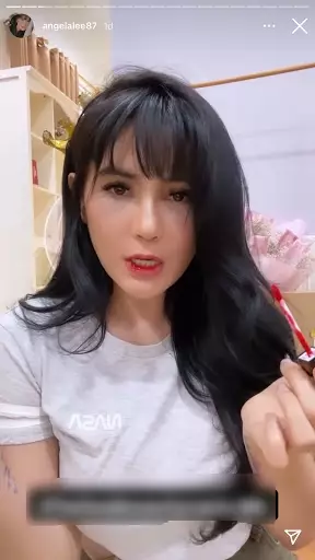 Angela Lee usai operasi hidung Instagram
