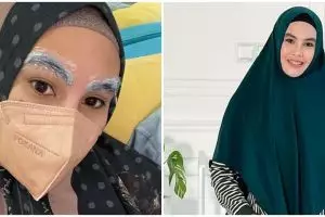 8 Cerita dan momen Kartika Putri laser alis, hasilnya mengejutkan