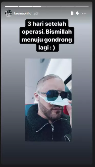 Kevin Aprilio lakukan transplantasi rambut Instagram