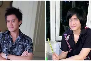 Lakukan transplantasi rambut, Kevin Aprilio beberkan alasannya