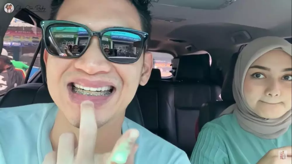 Momen Citra Kirana pasang behel © 2021 brilio.net