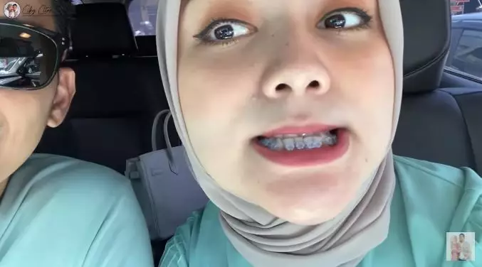 Momen Citra Kirana pasang behel © 2021 brilio.net