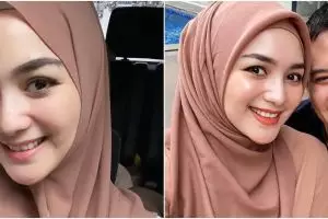 7 Momen Citra Kirana pasang behel, kembaran dengan Rezky Aditya