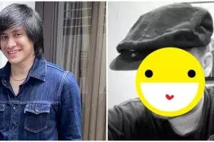 Usai transplantasi rambut, penampilan Kevin Aprilio bikin pangling