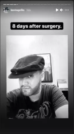 Kevin transplantasi rambut dan brewok Instagram