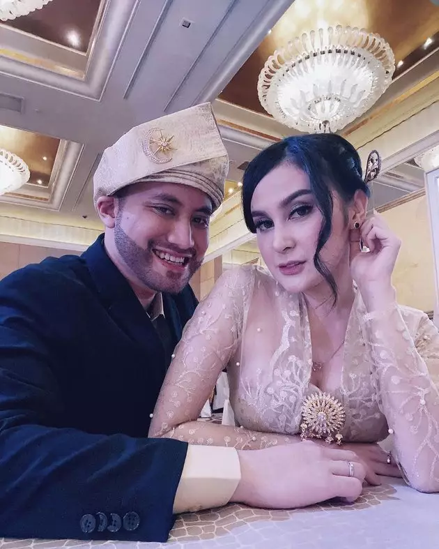 Kevin transplantasi rambut dan brewok Instagram