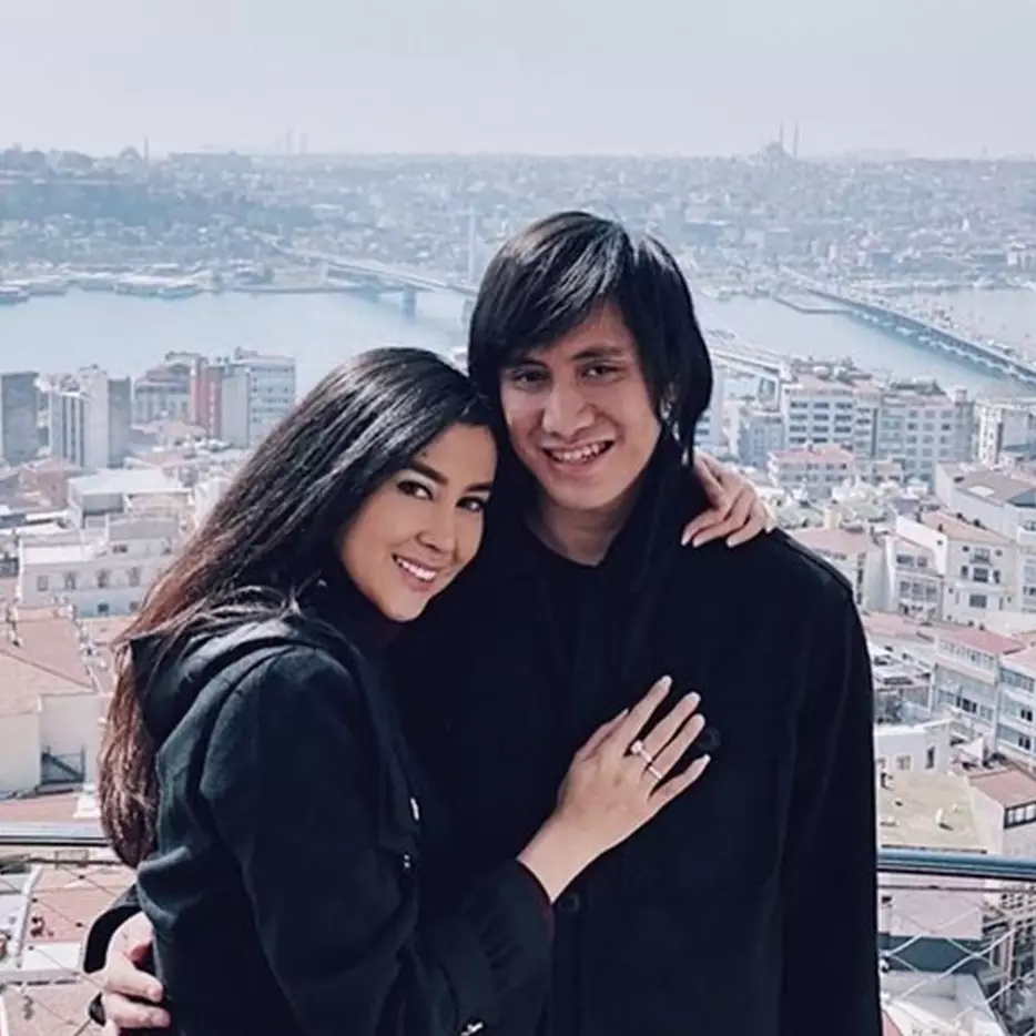 10 Potret terbaru Kevin Aprilio usai transplantasi rambut, manglingi