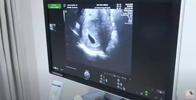 Feli cek kehamilan diantar Caesar Hito Berbagai sumber Feli cek kehamilan diantar Caesar Hito Berbagai sumber