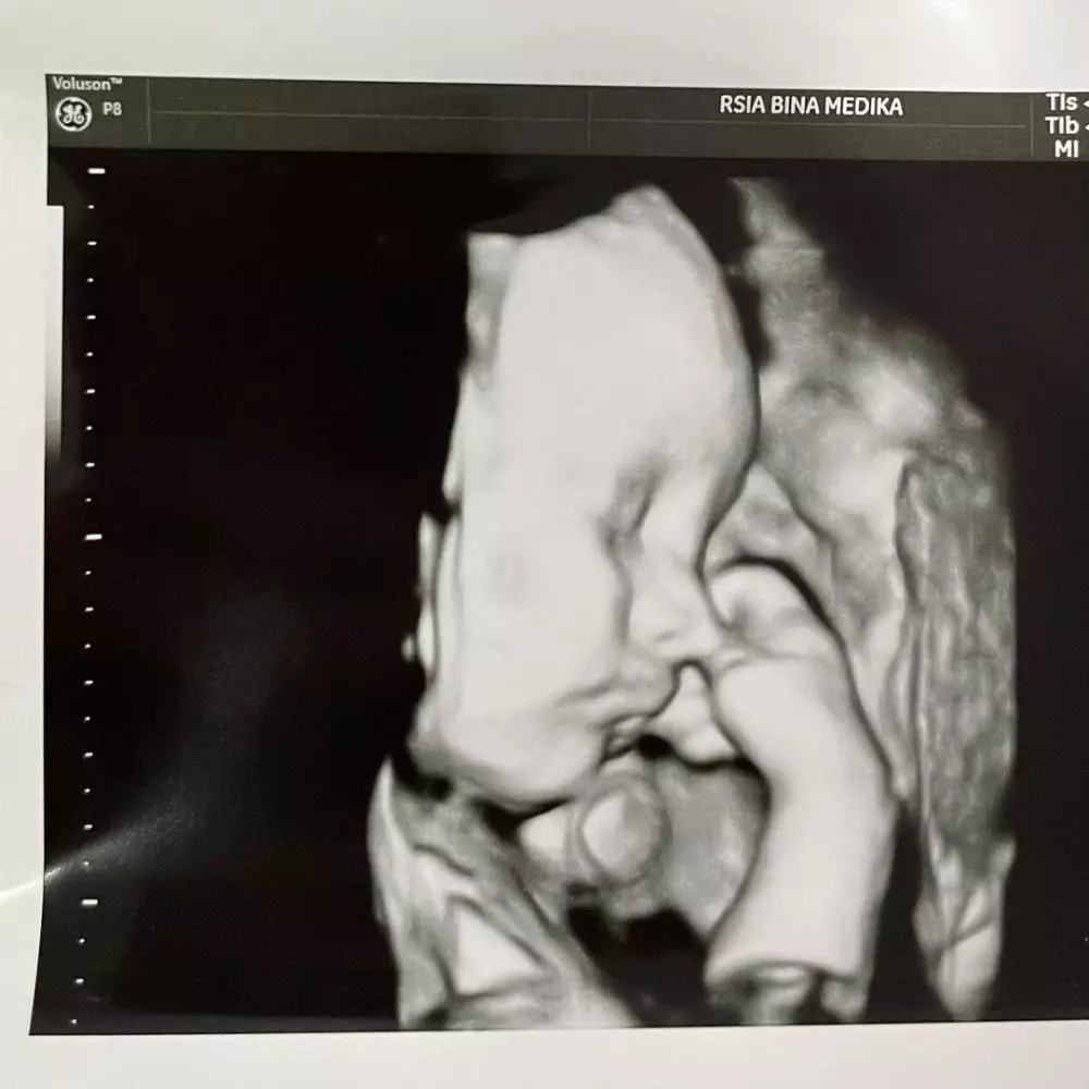 Audi Marissa melahirkan © 2021 brilio.net