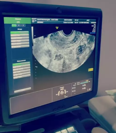 10 Momen Atta Halilintar temani Aurel Hermansyah cek kandungan berbagai sumber