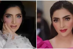 Pose bareng sahabatnya, wajah Ashanty bikin warganet khawatir