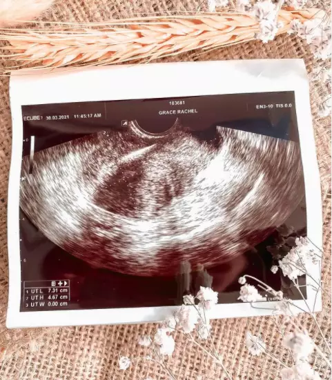 rachel goddard angkat rahim © 2021 brilio.net