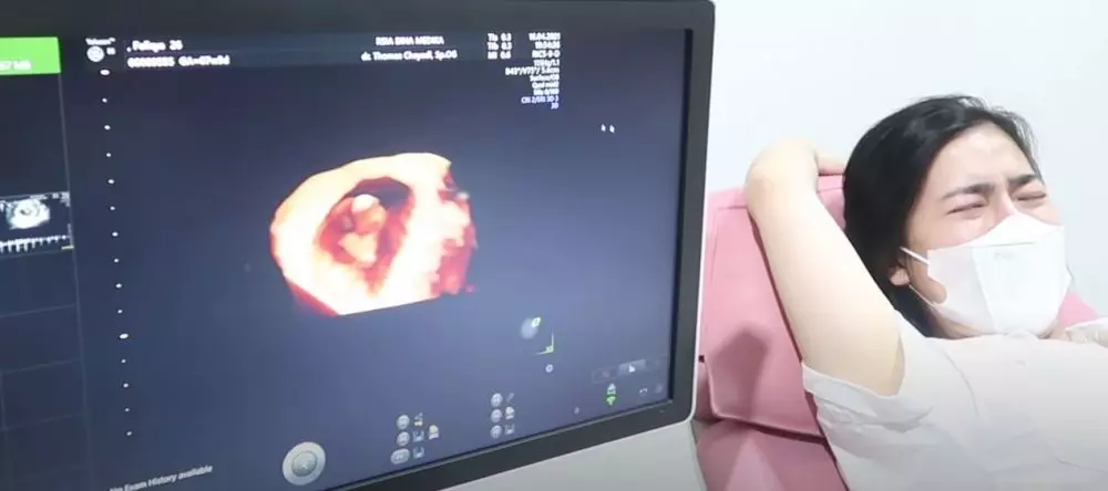 Felicya Angelista dan Caesar Hito menangis lihat USG © 2021 brilio.net YouTube