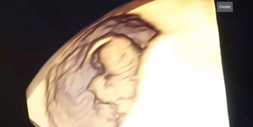 Felicya Angelista dan Caesar Hito menangis lihat USG © 2021 brilio.net YouTube