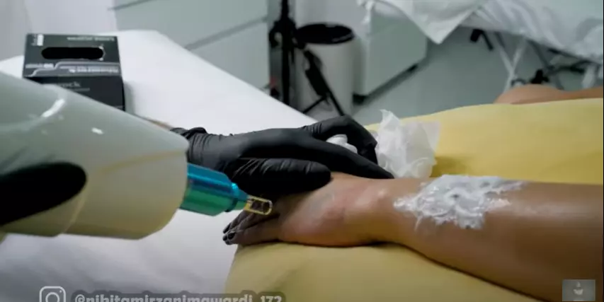 Momen Nikita Mirzani hapus tato Instagram dan YouTube