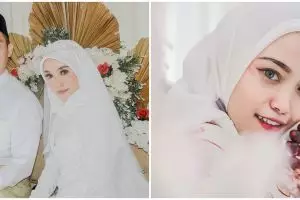 Viral pengantin bertangan bengkak, ternyata ini penyebabnya
